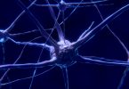 multiple sclerosis